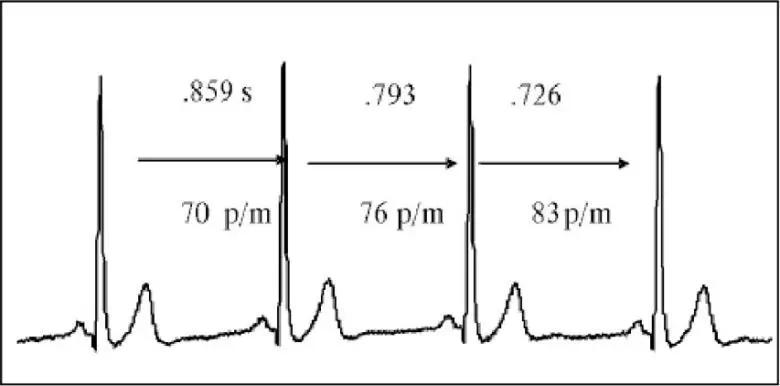 Variabilidad de la frecuencia cardíaca y respiración